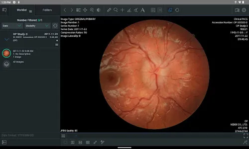 ResolutionMD screenshot 9