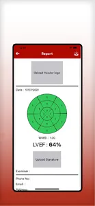 WMSI : Wall Motion Score Index screenshot 2
