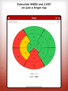 WMSI : Wall Motion Score Index screenshot 9