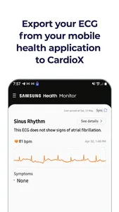 CardioX AI screenshot 3