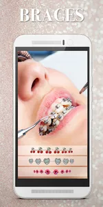 Braces Photo Editor - Beauty e screenshot 1