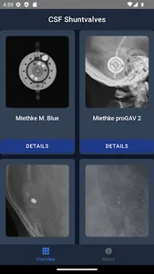 CSF Shuntvalves screenshot 0