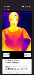 Dental Thermal App screenshot 1