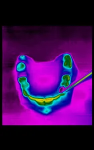 Dental Thermal App screenshot 10