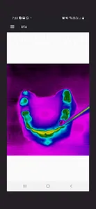 Dental Thermal App screenshot 2