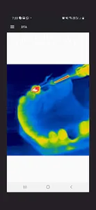 Dental Thermal App screenshot 3