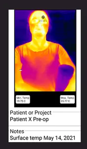 Dental Thermal App screenshot 5