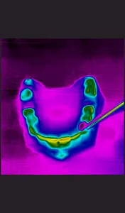 Dental Thermal App screenshot 6