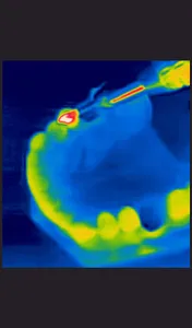 Dental Thermal App screenshot 7