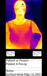 Dental Thermal App screenshot 9