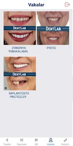 DentLab screenshot 2
