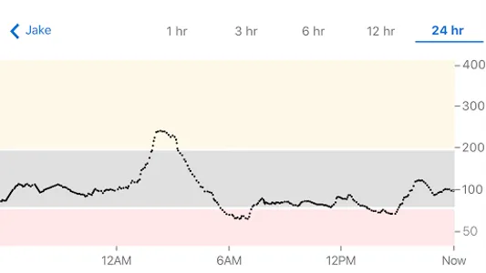 Dexcom Follow mg/dL DXCM10 screenshot 3