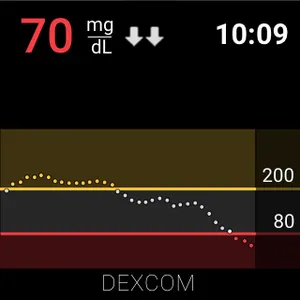 Dexcom G6 screenshot 8