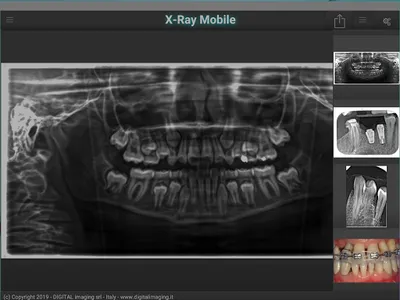 X-Ray Mobile screenshot 3