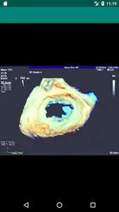 Texto de Cardiología SIAC RA screenshot 0