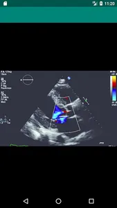 Texto de Cardiología SIAC RA screenshot 1