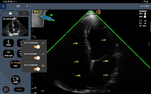 EchoNous Kosmos Ultrasound screenshot 5
