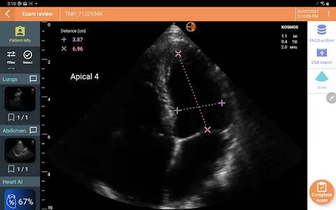 EchoNous Kosmos Ultrasound screenshot 4
