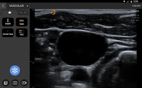 EchoNous Kosmos Ultrasound screenshot 7