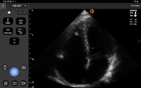 EchoNous Kosmos Ultrasound screenshot 9