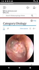 otolaryngologyonline screenshot 1
