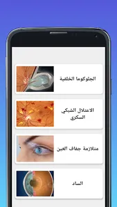 امراض العيون eyes illnesses screenshot 1