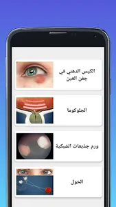 امراض العيون eyes illnesses screenshot 3