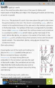 Dental Dictionary by Farlex screenshot 10