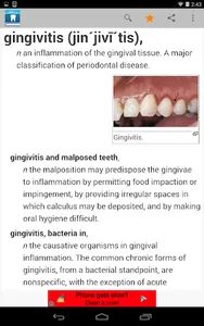 Dental Dictionary by Farlex screenshot 5