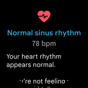 Fitbit ECG App screenshot 3