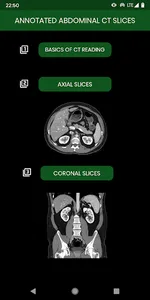 abdominal CT: annotated slices screenshot 0