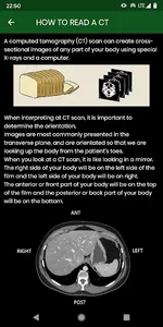 abdominal CT: annotated slices screenshot 1