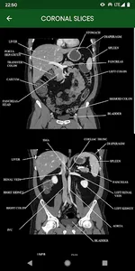 abdominal CT: annotated slices screenshot 3