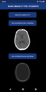 Brain CT : annotated slices screenshot 0