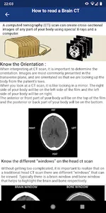 Brain CT : annotated slices screenshot 6
