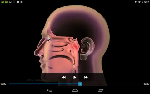 Otolaryngology-Dictionary screenshot 11