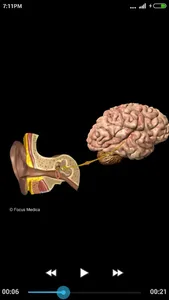 Otolaryngology-Dictionary screenshot 3