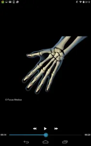 Rheumatology- Dictionary screenshot 7