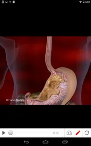Cholesterol screenshot 4