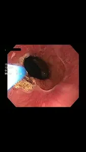 Gastro y Endo Oncologica RA 1 screenshot 0