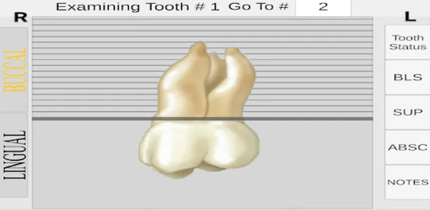 Periodontal Charting screenshot 3