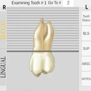 Periodontal Charting screenshot 4