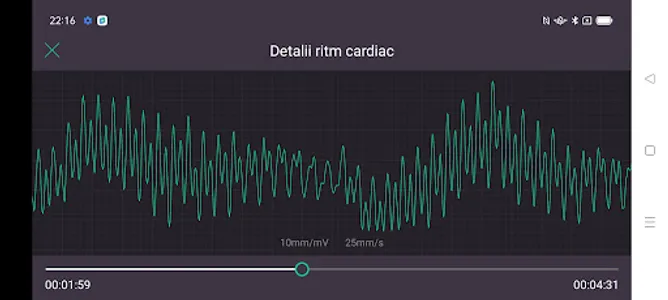 CDMS - ECG screenshot 1