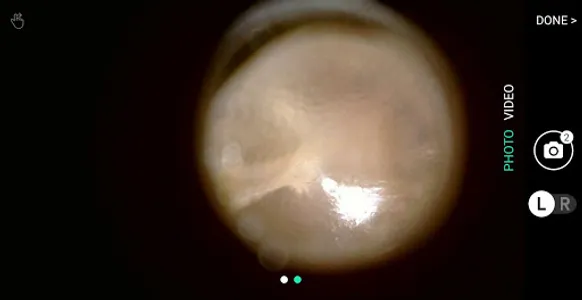 hearScope screenshot 1