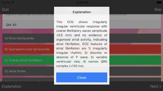 ECG Master: Quiz & Practice screenshot 3