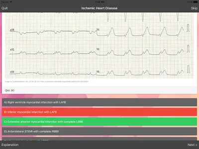 ECG Master: Quiz & Practice screenshot 6