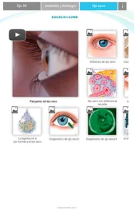 Oftalmología 3D screenshot 7