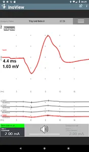 inoView screenshot 3