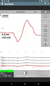 inoView screenshot 4