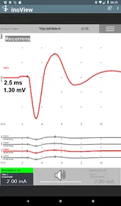 inoView screenshot 5